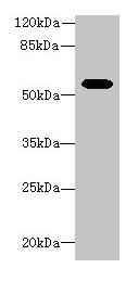 ALDH1A1 / ALDH1 Antibody - Western blot All lanes: Aldh1a1 antibody at 8µg/ml + Mouse eye tissue Secondary Goat polyclonal to rabbit IgG at 1/10000 dilution Predicted band size: 55 kDa Observed band size: 55 kDa
