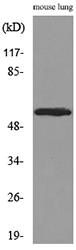 ALDH1A1 / ALDH1 Antibody - Western blot analysis of lysate from mouse lung, using ALDH1A1 Antibody.