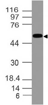 ALDH1A1 / ALDH1 Antibody - Fig-1: Expression analysis of ALDH1A1. Anti-ALDH1A1 antibody was used at 1 µg/ml on HepG2 lysate.