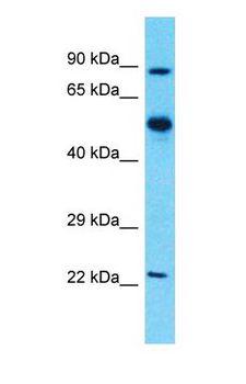 ALDH1A1 / ALDH1 Antibody - Western blot of ALDH1A1 Antibody with Esophagus Tumor lysate.  This image was taken for the unconjugated form of this product. Other forms have not been tested.