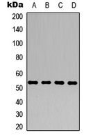 ALDH1A1 / ALDH1 Antibody - Western blot analysis of ALDH1A1 expression in HEK293T (A); Raw264.7 (B); NIH3T3 (C); PC12 (D) whole cell lysates.