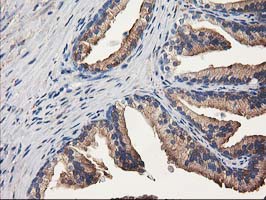 ALDH1A3 Antibody - IHC of paraffin-embedded Human prostate tissue using anti-ALDH1A3 mouse monoclonal antibody.