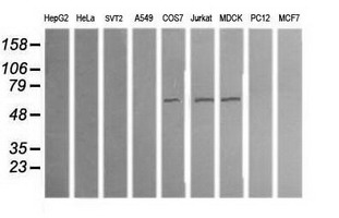 ALDH1A3 Antibody - Western blot of extracts (35ug) from 9 different cell lines by using anti-ALDH1A3 monoclonal antibody (HepG2: human; HeLa: human; SVT2: mouse; A549: human; COS7: monkey; Jurkat: human; MDCK: canine; PC12: rat; MCF7: human).
