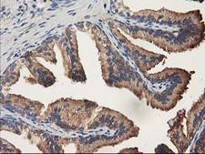 ALDH1A3 Antibody - IHC of paraffin-embedded Human prostate tissue using anti-ALDH1A3 mouse monoclonal antibody.