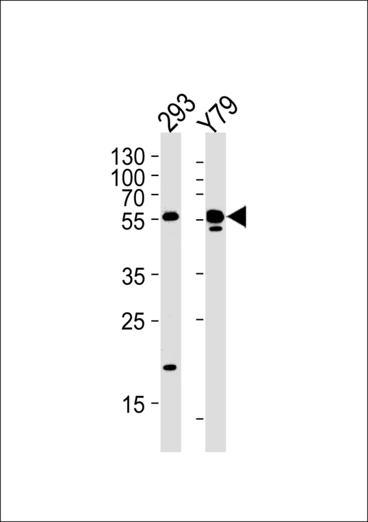 ALDH1A3 Antibody - ALDH1A3 Antibody western blot of 293,Y79 cell line lysates (35 ug/lane). The ALDH1A3 antibody detected the ALDH1A3 protein (arrow).