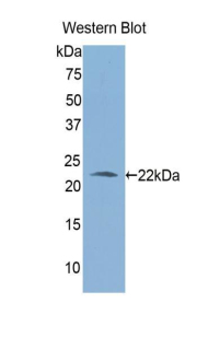 ALDH1A3 Antibody - Western blot of recombinant ALDH1A3.  This image was taken for the unconjugated form of this product. Other forms have not been tested.