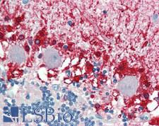 ALDH1A3 Antibody - Human Brain, Cerebellum: Formalin-Fixed, Paraffin-Embedded (FFPE)
