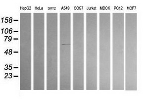 ALDH1A3 Antibody - Western blot of extracts (35 ug) from 9 different cell lines by using anti-ALDH1A3 monoclonal antibody (HepG2: human; HeLa: human; SVT2: mouse; A549: human; COS7: monkey; Jurkat: human; MDCK: canine; PC12: rat; MCF7: human).
