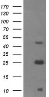 ALDH1A3 Antibody - Negative control E. coli lysate (Left lane) or E. coli lysate containing recombinant protein fragment for human ALDH1A3 (NP_000648) gene (the fusion of amino acids 1-100 and 413-512) (Right lane). Equivalent amounts (5 ug per lane) were separated by SDS-PAGE and then immunoblotted with anti-ALDH1A3. .