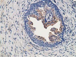 ALDH1A3 Antibody - IHC of paraffin-embedded Human prostate tissue using anti-ALDH1A3 mouse monoclonal antibody. (Heat-induced epitope retrieval by 10mM citric buffer, pH6.0, 120°C for 3min).