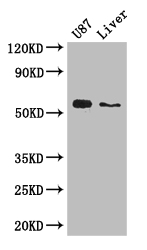 ALDH1A3 Antibody - Positive WB detected in:U87 whole cell lysate,Mouse liver tissue;All lanes: ALDH1A3 antibody at 3ug/ml;Secondary;Goat polyclonal to rabbit IgG at 1/50000 dilution;Predicted band size: 57 kDa;Observed band size: 57 kDa;