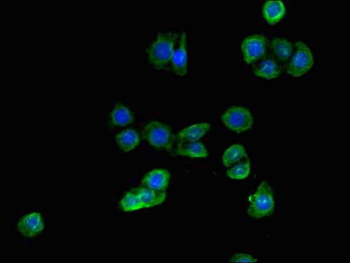 ALDH1A3 Antibody - Immunofluorescent analysis of PC3 cells using ALDH1A3 Antibody at a dilution of 1:100 and Alexa Fluor 488-congugated AffiniPure Goat Anti-Rabbit IgG(H+L)