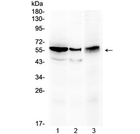ALDH1A3 Antibody - Western blot testing of 1) rat kidney, 2) mouse stomach and 3) human HepG2 lysate with ALDH1A3 antibody at 0.5ug/ml. Predicted molecular weight ~56 kDa.