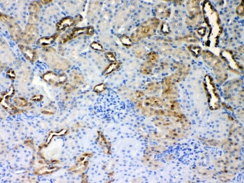ALDH1A3 Antibody - IHC testing of FFPE rat kidney tissue with ALDH1A3 antibody at 1ug/ml. Required HIER: steam section in pH6 citrate buffer for 20 min and allow to cool prior to testing.