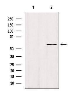 ALDH1A3 Antibody - Western blot analysis of extracts of 293 cells using ALDH1A3 antibody. Lane 1 was treated with the blocking peptide.