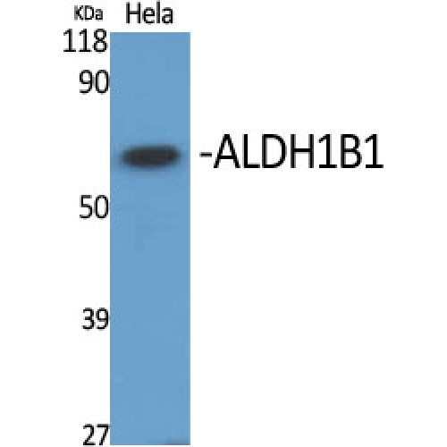 ALDH1B1 Antibody - Western blot of ALDH1B1 antibody