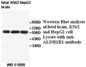 ALDH1B1 Antibody