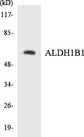 ALDH1B1 Antibody - Western blot analysis of the lysates from HepG2 cells using ALDH1B1 antibody.