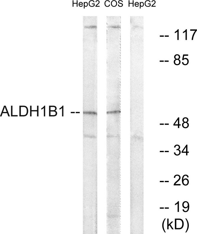 ALDH1B1 Antibody - Western blot analysis of lysates from HepG2 and COS cells, using ALDH1B1 Antibody. The lane on the right is blocked with the synthesized peptide.