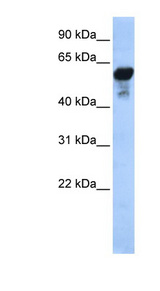 ALDH1B1 Antibody - ALDH1B1 antibody Western blot of HeLa lysate. This image was taken for the unconjugated form of this product. Other forms have not been tested.