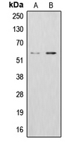 ALDH1B1 Antibody - Western blot analysis of ALDH1B1 expression in K562 (A); HepG2 (B) whole cell lysates.
