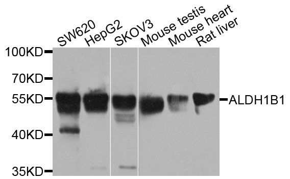 ALDH1B1 Antibody - Western blot analysis of extract of various cells.