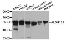 ALDH1B1 Antibody - Western blot analysis of extract of various cells.