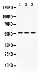 ALDH1B1 Antibody - Western blot - Anti-ALDH1B1 Picoband Antibody