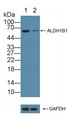 ALDH1B1 Antibody - Knockout Varification: Lane 1: Wild-type K562 cell lysate; Lane 2: ALDH1B1 knockout K562 cell lysate; Predicted MW: 59kd Observed MW: 59kd Primary Ab: 1µg/ml Rabbit Anti-Human ALDH1B1 Antibody Second Ab: 0.2µg/mL HRP-Linked Caprine Anti-Rabbit IgG Polyclonal Antibody