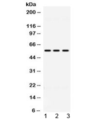 ALDH1B1 Antibody - Western blot testing of 1) rat liver, 2) mouse liver and 3) human HeLa lysate with ALDH1B1 antibody at 0.5ug/ml. Predicted/observed molecular weight ~57 kDa.