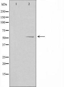 ALDH1B1 Antibody - Western blot analysis of extracts of HepG2 cells using ALDH1B1 antibody. The lane on the left is treated with the antigen-specific peptide.