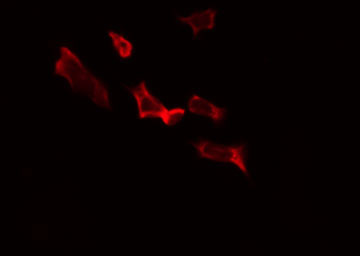 ALDH1B1 Antibody - Staining HepG2 cells by IF/ICC. The samples were fixed with PFA and permeabilized in 0.1% Triton X-100, then blocked in 10% serum for 45 min at 25°C. The primary antibody was diluted at 1:200 and incubated with the sample for 1 hour at 37°C. An Alexa Fluor 594 conjugated goat anti-rabbit IgG (H+L) Ab, diluted at 1/600, was used as the secondary antibody.