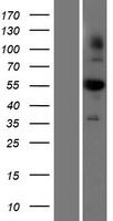 ALDH1B1 Protein - Western validation with an anti-DDK antibody * L: Control HEK293 lysate R: Over-expression lysate