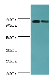 ALDH1L1 Antibody - Western blot. All lanes: Cytosolic 10-formyltetrahydrofolate dehydrogenase antibody at 8 ug/ml. Lane 1: mouse liver tissue. Lane 2: mouse gonad tissue. Secondary antibody: Goat polyclonal to rabbit at 1:10000 dilution. Predicted band size: 99 kDa. Observed band size: 99 kDa.