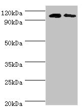 ALDH1L1 Antibody - Western blot All lanes: Cytosolic 10-formyltetrahydrofolate dehydrogenase antibody at 8µg/ml Lane 1: Mouse liver tissue Lane 2: Mouse gonad tissue Secondary Goat polyclonal to rabbit IgG at 1/10000 dilution Predicted band size: 99, 88, 100, 56 kDa Observed band size: 99 kDa