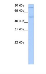 ALDH1L1 Antibody - Fetal liver cell lysate. Antibody concentration: 0.5 ug/ml. Gel concentration: 12%.  This image was taken for the unconjugated form of this product. Other forms have not been tested.
