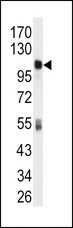 ALDH1L1 Antibody - Western blot of anti-ALDH1L1 Antibody in mouse liver tissue lysates (35 ug/lane). ALDH1L1(arrow) was detected using the purified antibody.