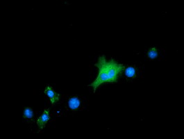 ALDH1L1 Antibody - Anti-ALDH1L1 mouse monoclonal antibody  immunofluorescent staining of COS7 cells transiently transfected by pCMV6-ENTRY ALDH1L1.