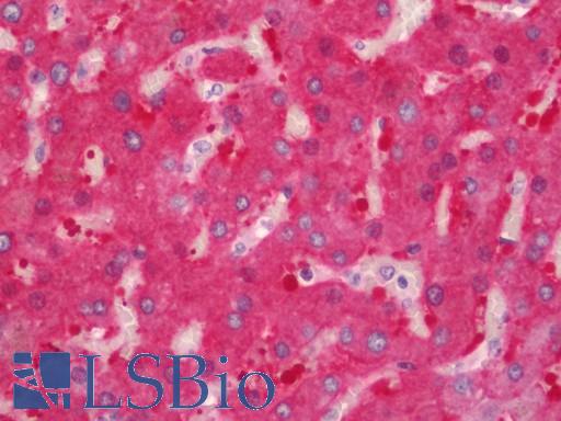 ALDH1L1 Antibody - Human Liver: Formalin-Fixed, Paraffin-Embedded (FFPE)