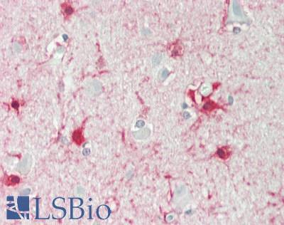 ALDH1L1 Antibody - Human Brain, Cortex: Formalin-Fixed, Paraffin-Embedded (FFPE)