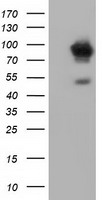 ALDH1L1 Antibody - HEK293T cells were transfected with the pCMV6-ENTRY control (Left lane) or pCMV6-ENTRY ALDH1L1 (Right lane) cDNA for 48 hrs and lysed. Equivalent amounts of cell lysates (5 ug per lane) were separated by SDS-PAGE and immunoblotted with anti-ALDH1L1.