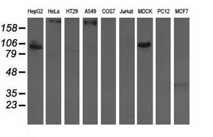 ALDH1L1 Antibody - Western blot of extracts (35 ug) from 9 different cell lines by using anti-ALDH1L1 monoclonal antibody.