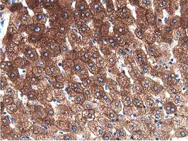ALDH1L1 Antibody - IHC of paraffin-embedded Human liver tissue using anti-ALDH1L1 mouse monoclonal antibody.