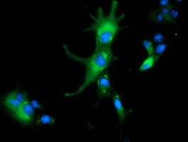 ALDH1L1 Antibody - Anti-ALDH1L1 mouse monoclonal antibody  immunofluorescent staining of COS7 cells transiently transfected by pCMV6-ENTRY ALDH1L1.