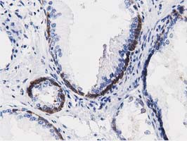 ALDH1L1 Antibody - IHC of paraffin-embedded Human prostate tissue using anti-ALDH1L1 mouse monoclonal antibody.