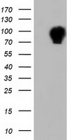 ALDH1L1 Antibody - HEK293T cells were transfected with the pCMV6-ENTRY control (Left lane) or pCMV6-ENTRY ALDH1L1 (Right lane) cDNA for 48 hrs and lysed. Equivalent amounts of cell lysates (5 ug per lane) were separated by SDS-PAGE and immunoblotted with anti-ALDH1L1.