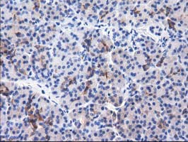 ALDH1L1 Antibody - Immunohistochemical staining of paraffin-embedded Human pancreas tissue using anti-ALDH1L1 mouse monoclonal antibody.
