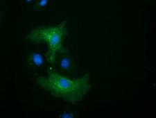 ALDH1L1 Antibody - Anti-ALDH1L1 mouse monoclonal antibody  immunofluorescent staining of COS7 cells transiently transfected by pCMV6-ENTRY ALDH1L1.