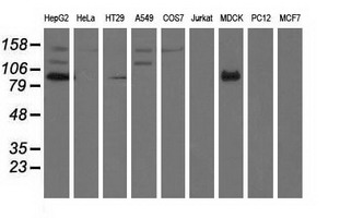 ALDH1L1 Antibody - Western blot analysis of extracts (35ug) from 9 different cell lines by using anti-ALDH1L1 monoclonal antibody.
