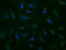 ALDH1L1 Antibody - Immunofluorescent staining of HeLa cells using anti-ALDH1L1 mouse monoclonal antibody.